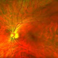 Logo Retina-Vitreous Consultants, Inc.